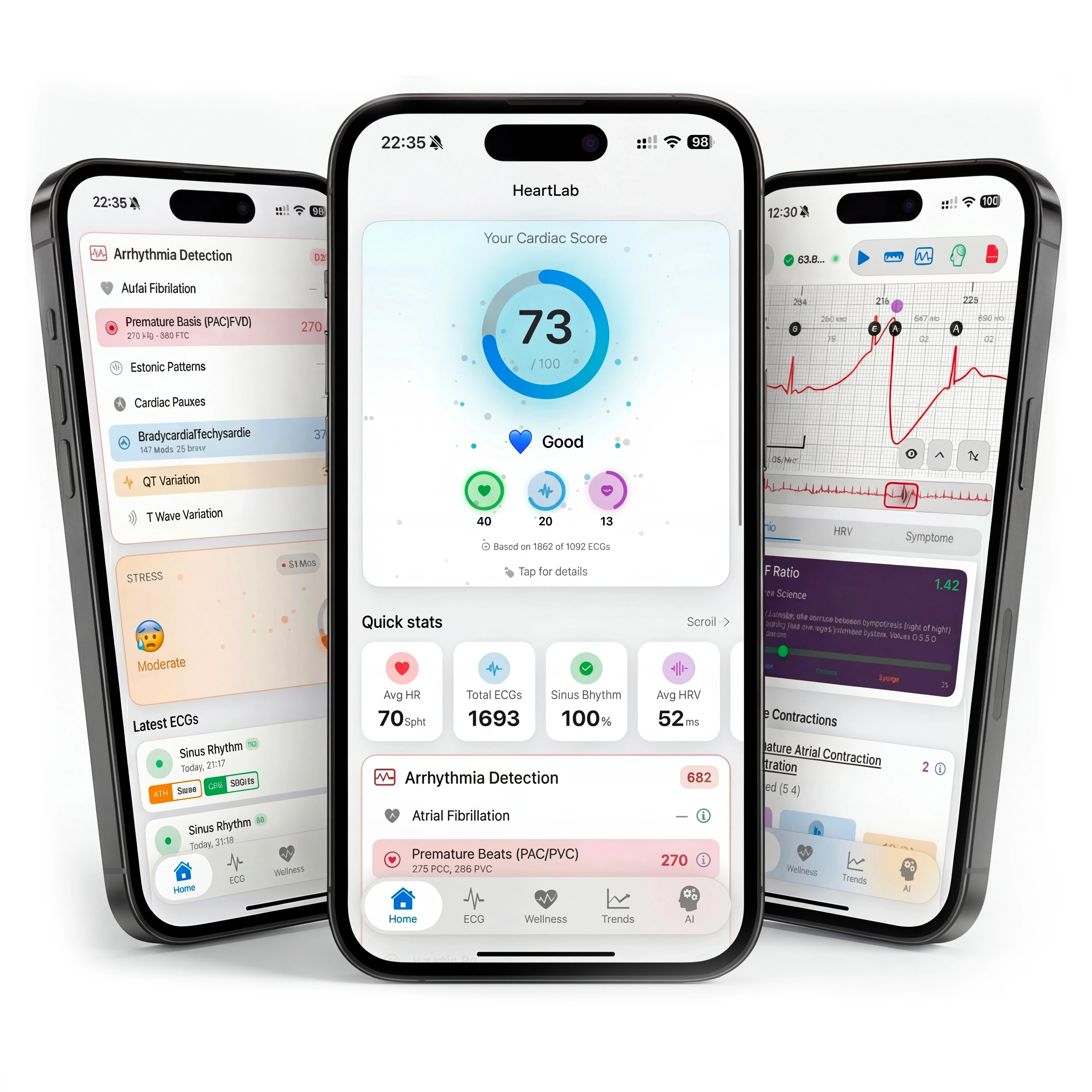 HeartLab App Screenshots