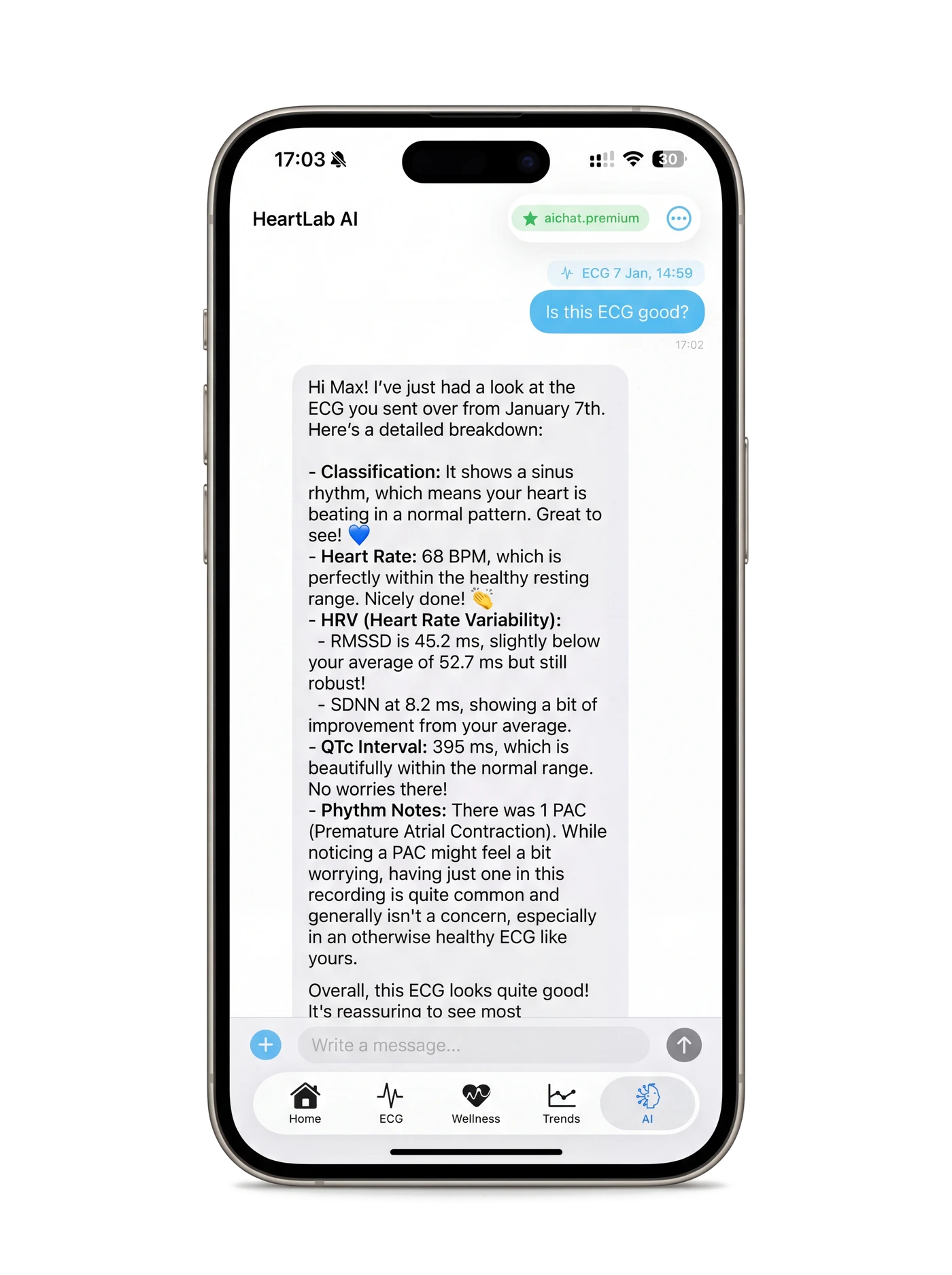 Asistente IA para ECG en HeartLab